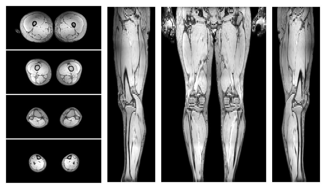 The out-phase image of the dixon reconstruction for water fat quantification.